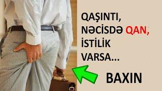 Nəcisdə qan varsa - Buna diqqət edin!