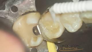 restorative dentistry ultra HD 4 k