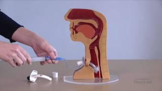 Tracheostomy - Respiratory, phonatory and swallowing function - TRACS WA