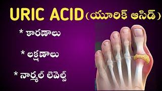 High URIC ACID causes , symptoms in Telugu ( యూరీక్ యాసిడ్ )