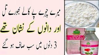 How To Remove Brown Ans Black Moles (Til) _Dagh Dhabon Ka Ilaj _Til kahatm Karny Ka Tareeka Natural.