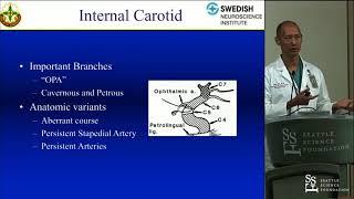 Neuroangiographic Anatomy - Yince Loh, MD, FNCS