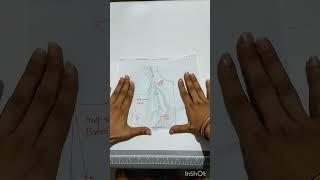 How to convert 2 DART BODIES into DARTLESS BODIES.