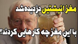 مغز انیشتین دزدیده شد؛ دانشمندان با مغز انیشتین چه کرده اند؟