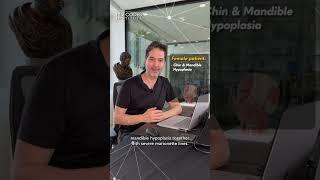 MD Codes Complex: Episode 4 (1 Dec 2023) - Mauricio de Maio