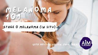 What is Stage 0 (in situ) Melanoma?