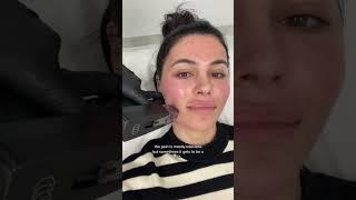 Skin tightening treatment that is worth it I did 3 sessions