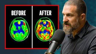 Does Dopamine Detoxing Actually Work? - Andrew Huberman