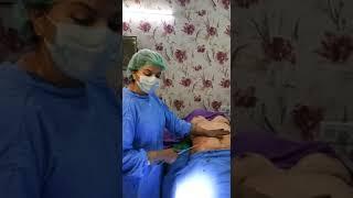 Figure Correction and Fat Remove Abdominoplasty, Liposuction Surgery Procedure by Dr. Charu Sharma