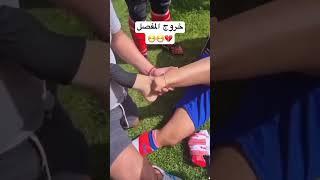 اصابة المفصل 