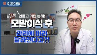 대구 모발이식, 이식 후 주의사항 필독!!!!! 이건 지켜줘~