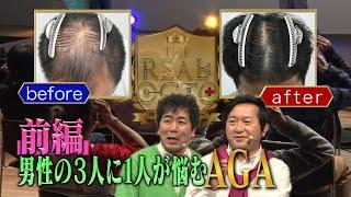 【AGA薄毛で悩んでいる人必見】薄毛の進行を止めるために知っておきたいこと！効果的な治療法とは？マッサージは効果ある！？ザ・リアルドクターAGA編がついに開幕！湘南AGAクリニック