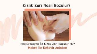 Kızlık Zarı Nasıl Bozulur? Mastürbasyon Yaptım Kızlık Zarım Bozulur Mu? -Op. Dr. Meral Sönmezer