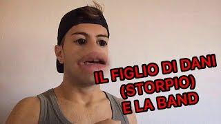 IL FIGLIO DI DANI (STORPIO) E LA BAND