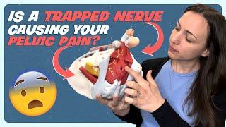 Understanding Pudendal Nerve Entrapment and Neuralgia: Causes and Symptoms