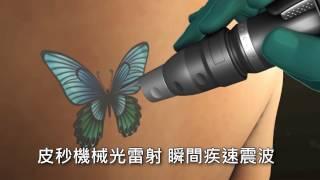 【PicoSure蜂巢 皮秒雷射】直擊斑點、痘疤、皺紋｜ 彤顏診所皮膚管理專家