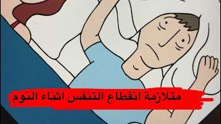 د. اياد الجردان: انقطاع التنفس اثناء النوم