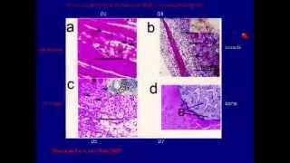 Rosen: Muscle and Brown Fat: Origins and Relationship to Bone