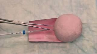 Hormonal IUD (LNG-IUS) Insertion Technique