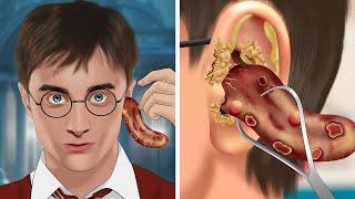 ASMR Help Harry Potter remove his tongue from his ear | WOW Brain Satisfying video