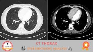 CT Thorax - Systematische Bildanalyse