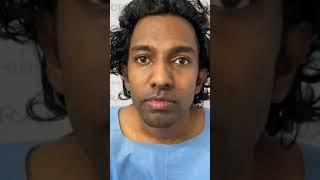 Face Transformation Surgery - Genioplasty And Rhinoplasty | Jawline Surgery In Kerala #shorts