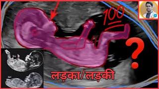 PREGNANCY ULTRASOUND REPORT IN HINDI/PREGNANCY ULTRASOUND REPORT कैसे देखते हैं/PREGNANCY REPORT