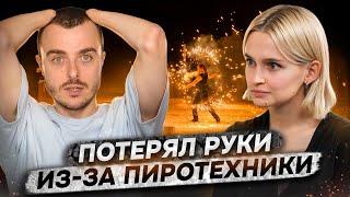 ‎«Пальцы разлетелись по всей округе» | Костя Бионическая Россия