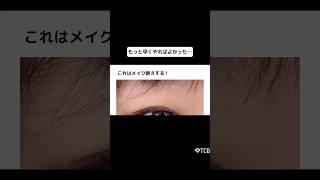【二重整形】もっと早くやればよかった これはメイク映えする！ #shorts