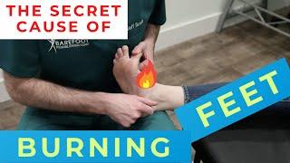 The Secret Cause of Chronic **BURNING FEET** (Can't Catch Dr. Chris??) & How to Fix