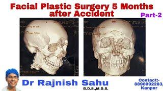 Face Surgery ||Cosmetic surgery in india ||Dr Rajnish Sahu