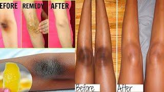 HOW TO LIGHTEN DARK UNDERARM NATURALLY ANDFAST | PERMANENT RESULTS