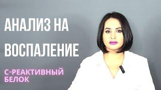 Анализ на воспаление: С-реактивный белок