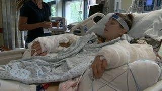 Quadruple Amputee Undergoes Hand Transplant Surgery