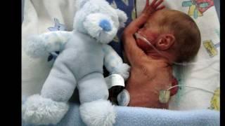 24 Week Preemie - Christiaan Brink: Jou eerste jaar / Your first year