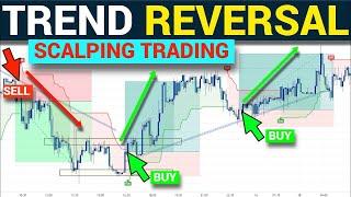 99% Accurate Price Action Strategies Price Action Scalping Trading Like a Pro | Forex Strategies