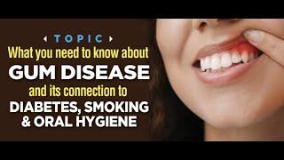 GUM DISEASE AND ITS CONNECTION TO SMOKING, DIABETES, AND ORAL HYGIENE