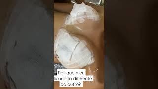 UM SILICONE ESTA MAIOR QUE O OUTRO/ POR QUE