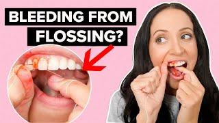 If Your Gums Bleed When You Floss... Watch This Video!