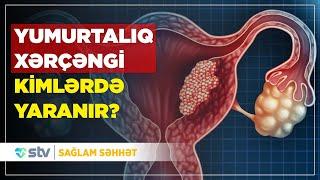 YUMURTALIQ XƏRÇƏNGİNİN MÜALİCƏSİ NECƏ APARILIR? - SAĞLAM SƏHHƏT (25.09.2024)