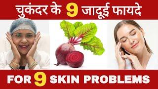 चुकंदर के 9 जादूई फायदे| 9 फायदा चौंका देगा  #beetroot #skin #glow #trending