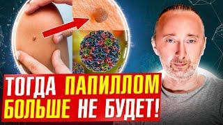 Папилломы снаружи и изнутри можно убрать Вот ТАК: рецепты!