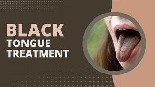 Black Tongue Treatment: 2 Effective Ways To Prevent It