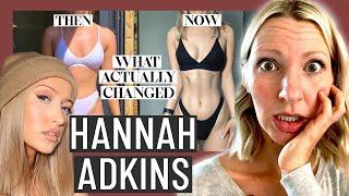 Dietitian Reviews Hannah Adkin's Tips for Losing Fat (Yikes... be careful what "experts" you trust)