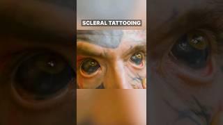 Eyeball Tattoo!? (Scleral Tattoo)