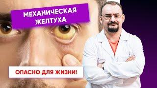 Механическая желтуха - объяснение этого состояния от доктора Голода.