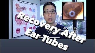 Post Op Ear Tubes: can you swim, when can you fly, how do you use ear drops