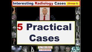 5 Interesting Radiology Cases (Episode 3)