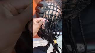 This Amazing Alopecia Transformation Shows How Anyone Can Have Beautiful Hair Again!