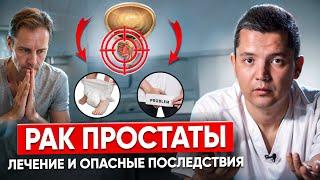 Как вылечить рак простаты без последствий. Профилактика рака простаты.